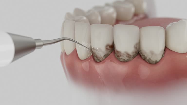 Reliable Dental contractor in Carrollton, MO by Dentist Open Now
